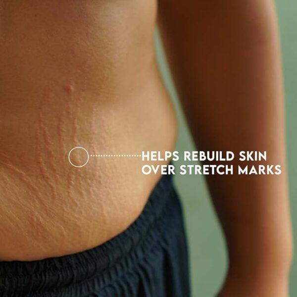 Furr Organic Stretch Mark Oil